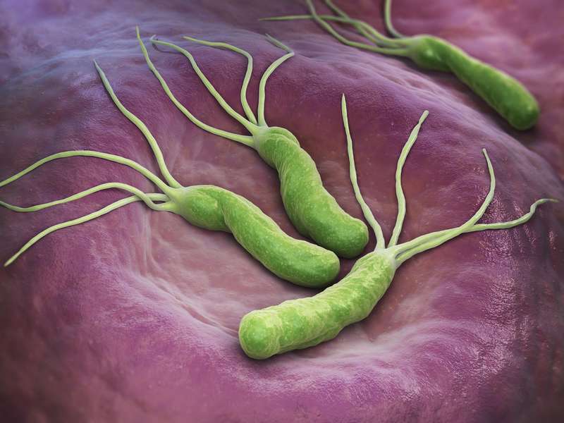 Mistakes in the management of Helicobacter pylori infection
